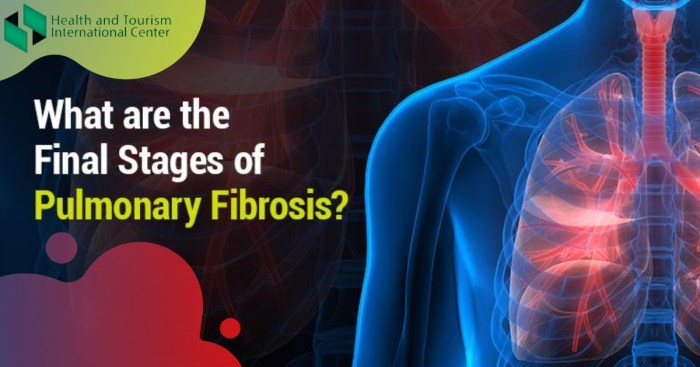 Clubbing causes pulmonary fibrosis curved finger fingernail test downward